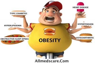 Effects of obesity. People should know this information.